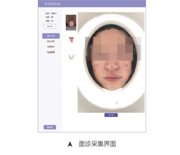 中医四诊仪（舌面脉信息采集管理系统02型）MT-SMT-02面诊采集界面.png