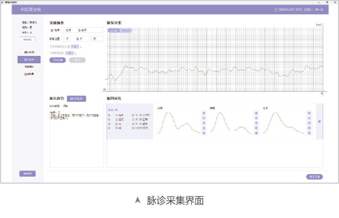 中医四诊仪（舌面脉信息采集管理系统02型）MT-SMT-02脉诊采集界面.png