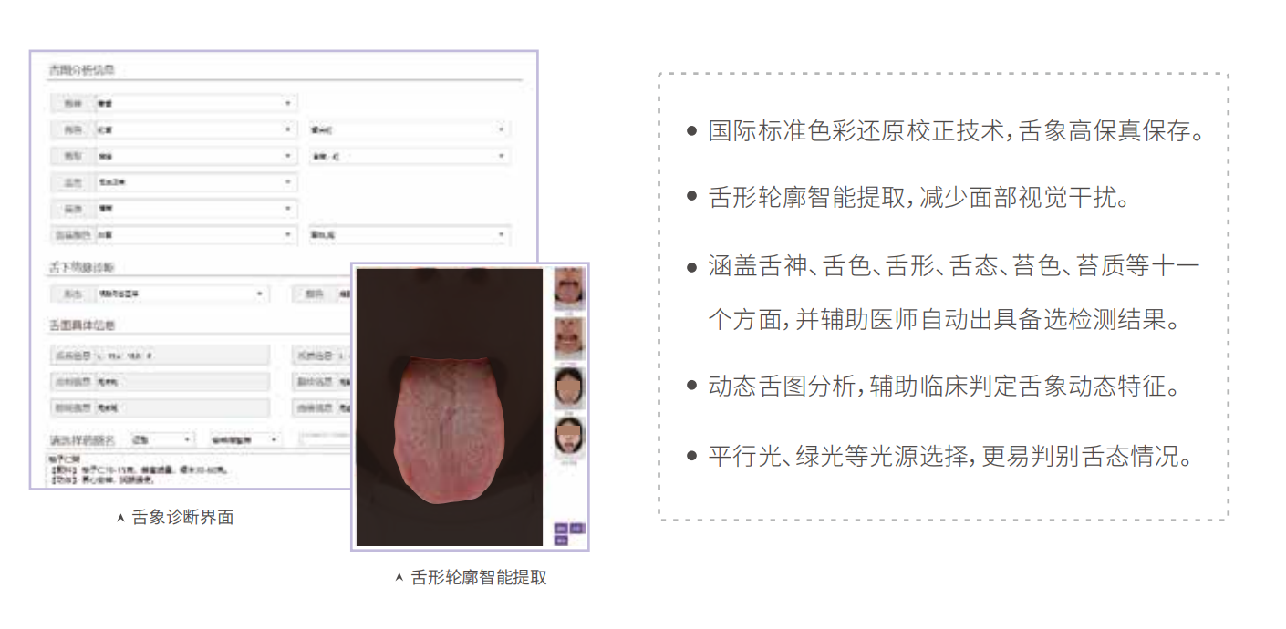 舌诊仪（中医舌象信息采集管理系统）MT-SX-02舌象分析特点.png