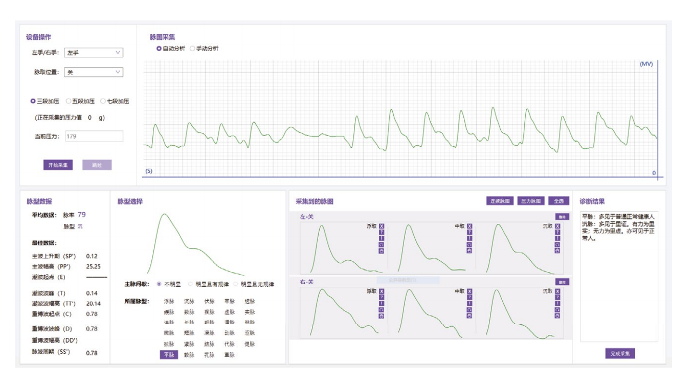 中医脉诊仪系统特点.png