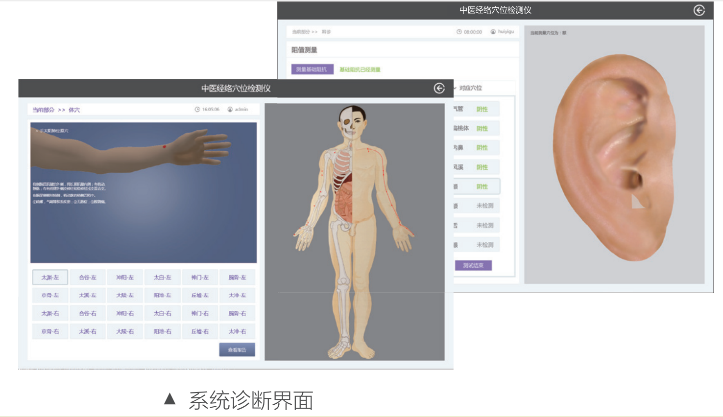 笔式中医经络穴位检测仪（MT-JX-01）系统诊断界面.png